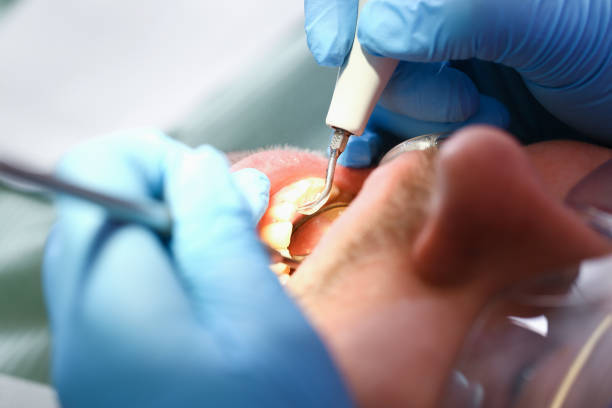 Best Emergency Treatment for Toothache in Monteagle, TN