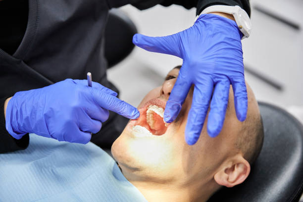 Best Emergency Tooth Extraction in Monteagle, TN