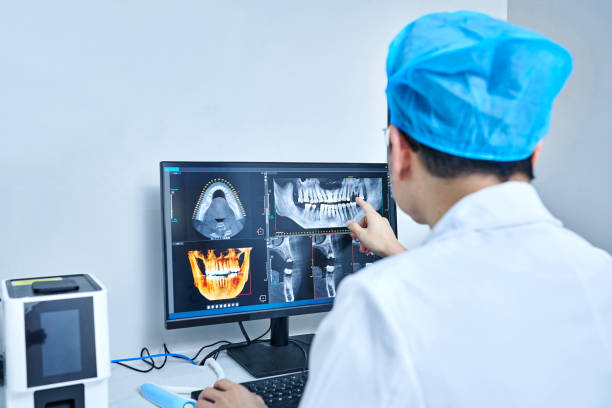 Best Emergency Wisdom Teeth Removal in Monteagle, TN