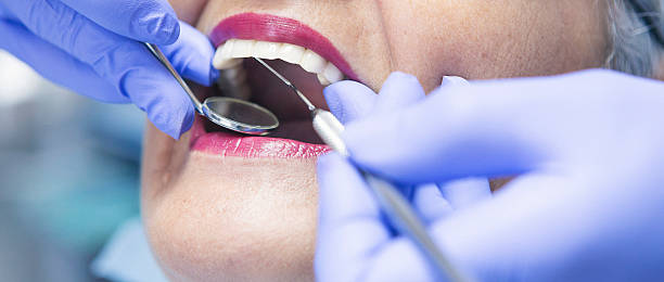 Best Emergency Root Canal Treatment in Monteagle, TN