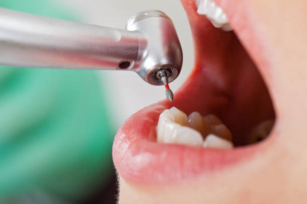 Best Emergency Broken Tooth Repair in Monteagle, TN